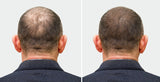 Hair Regrowth Oil + Hair Regrowth Shampoo (Free)