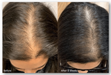 Hair Regrowth Oil + Hair Regrowth Shampoo (Free)